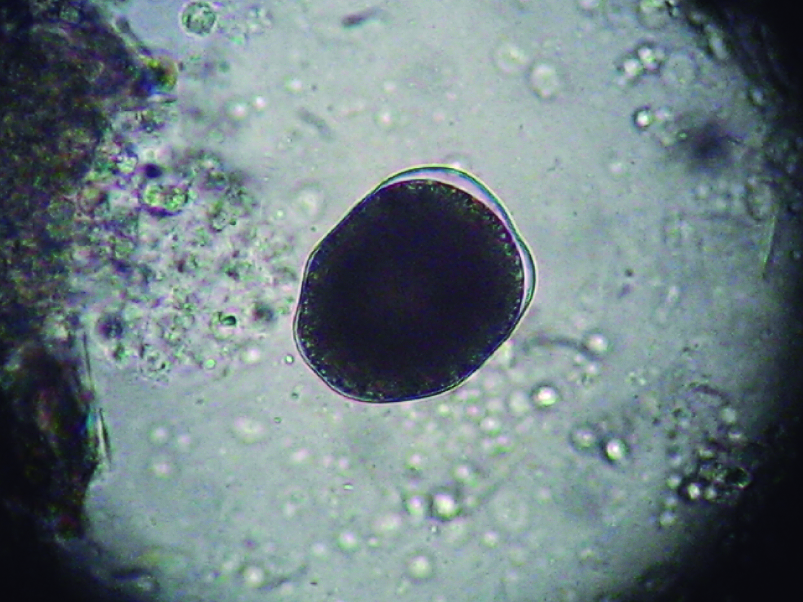Amyloodiniasis