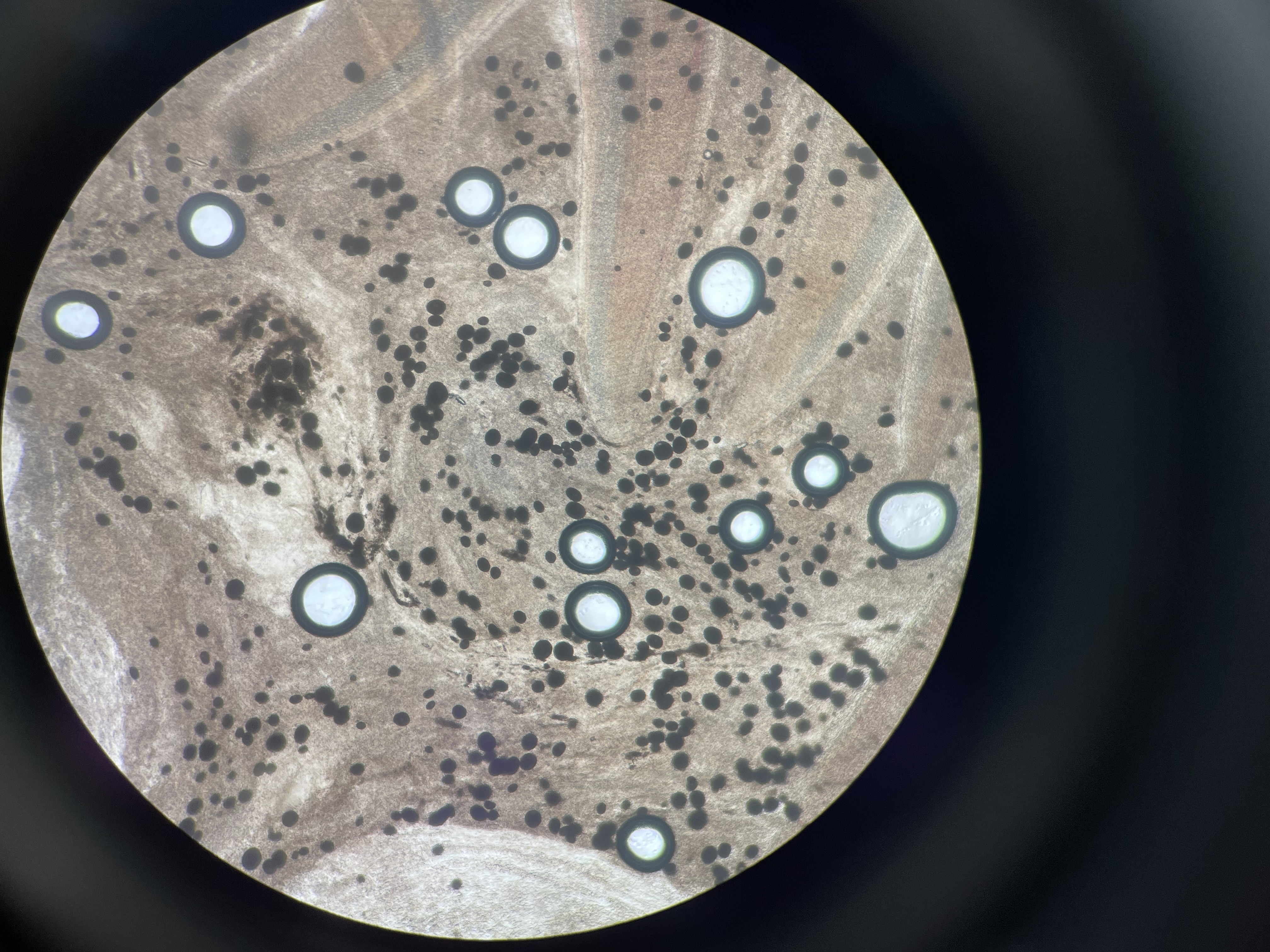 Amyloodiniasis