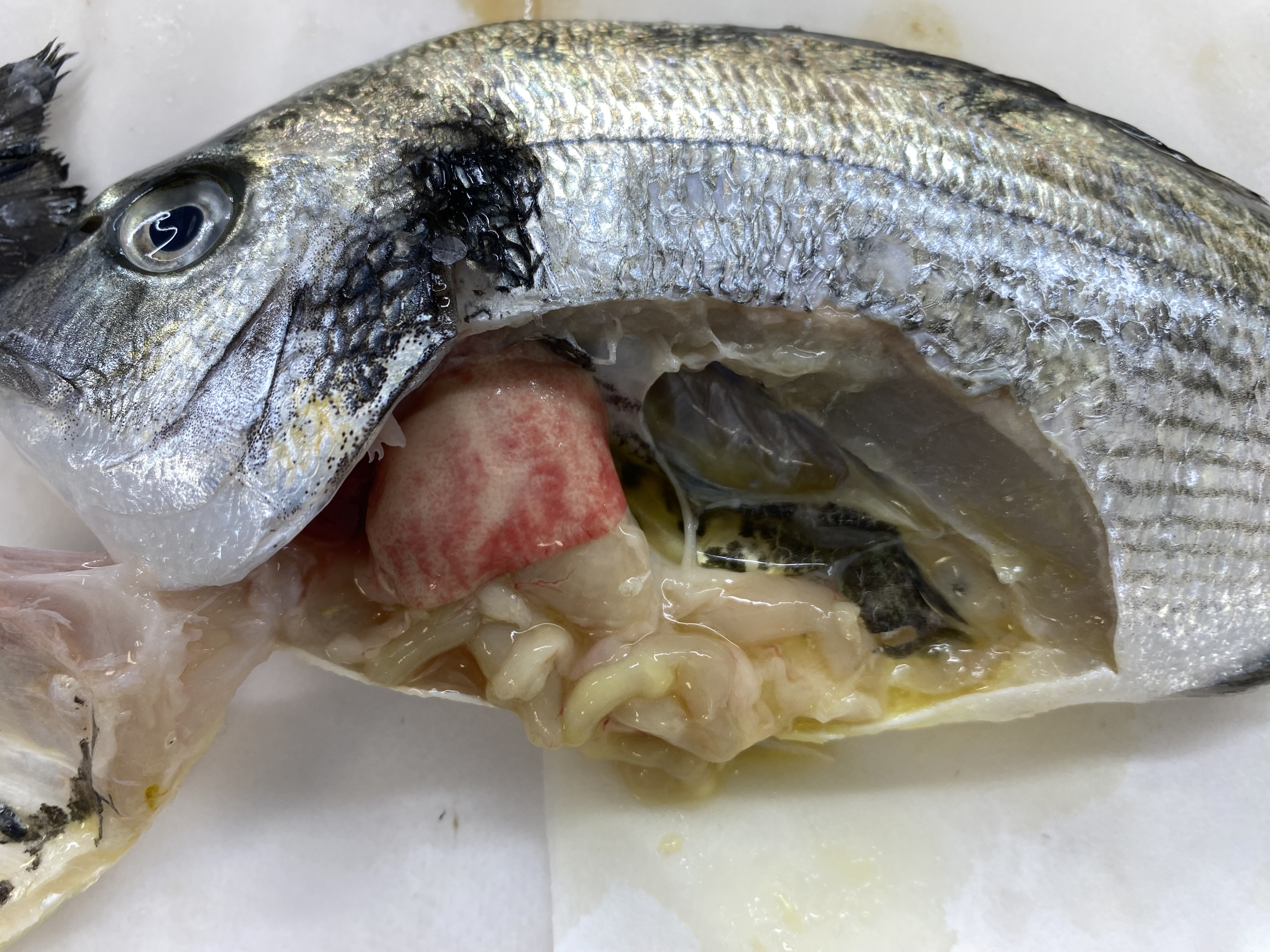 Digestive Microsporidiosis