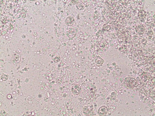 Enteromyxosis