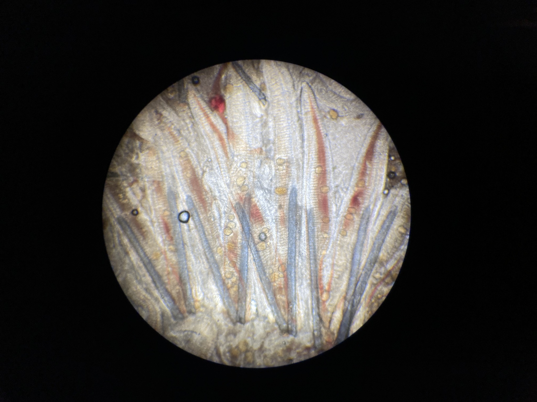 Epitheliocystis