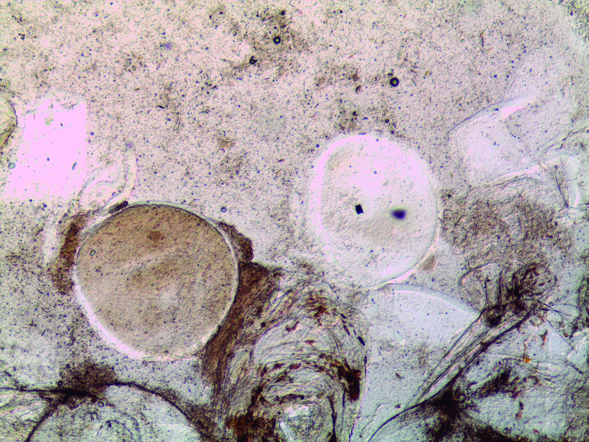 Lymphocystis
