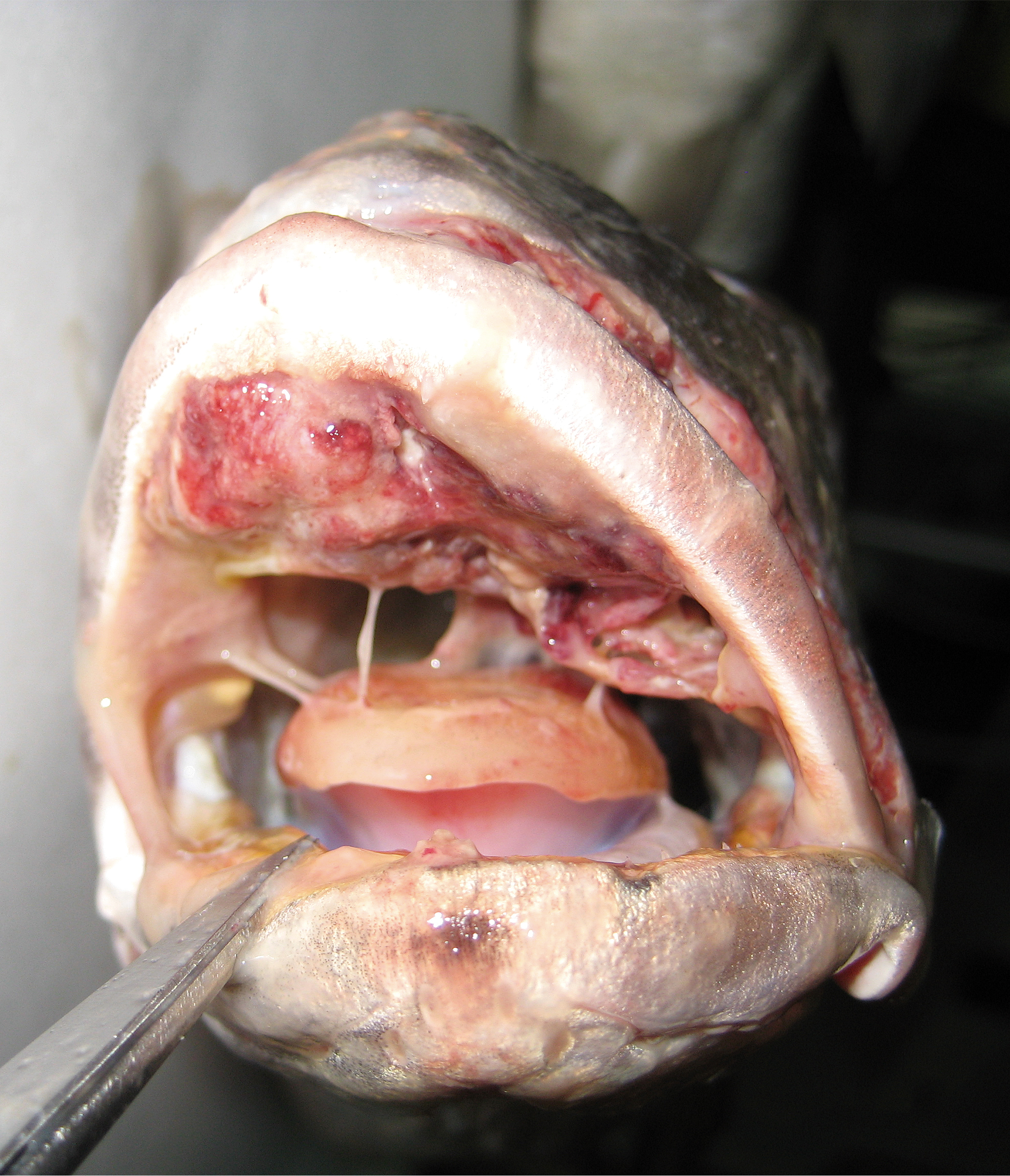 Nocardiosis