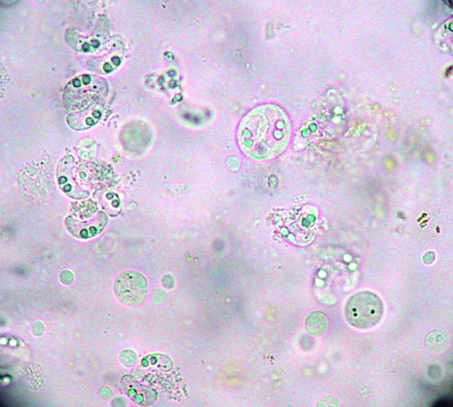 Ceratomyxa