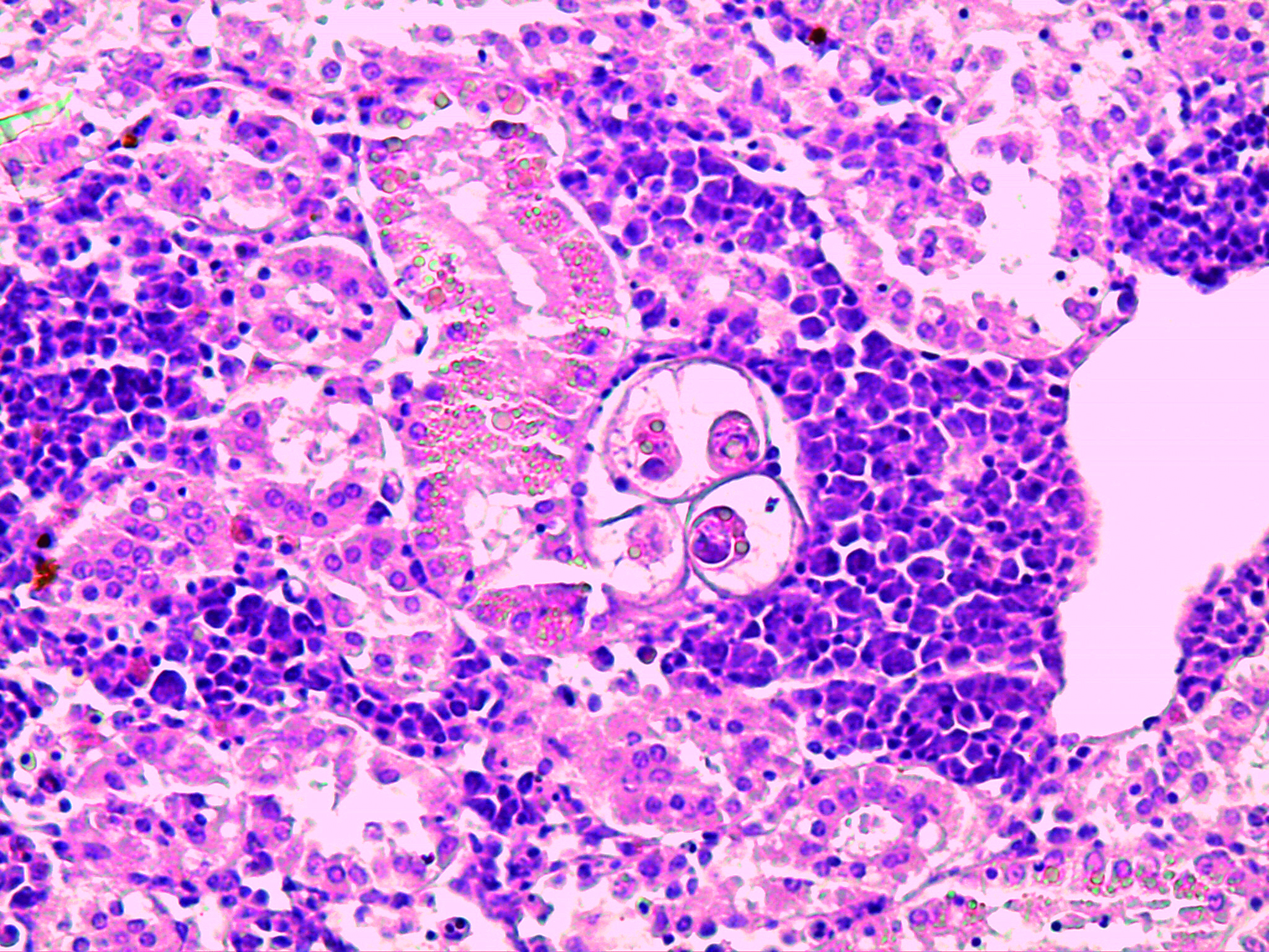 Polisporoplasma sparis