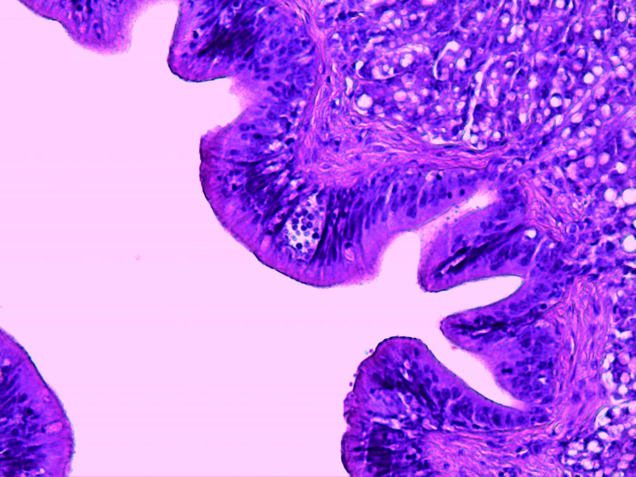 Cryptosporidium molnari:
