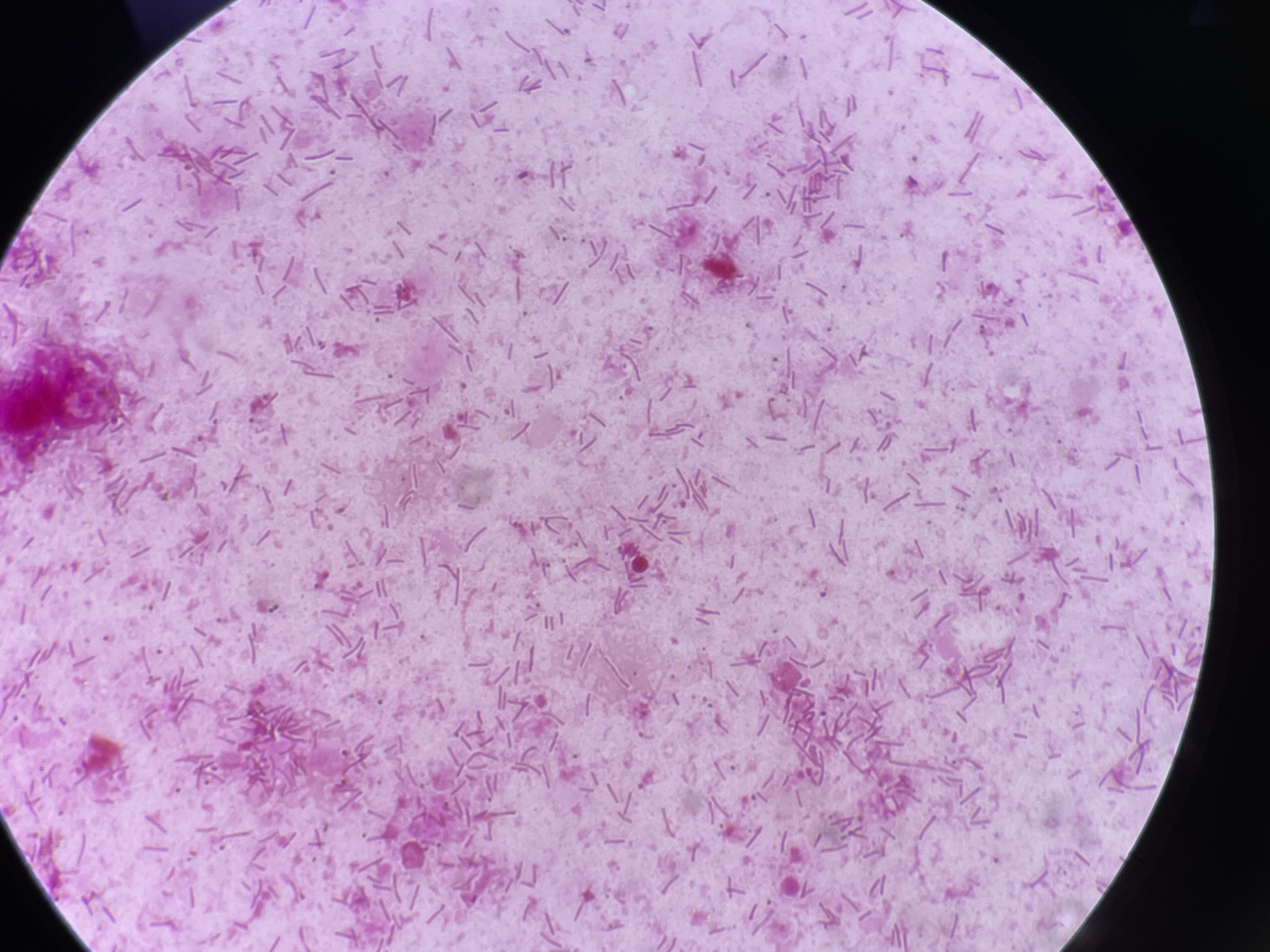 Tenacibaculosis