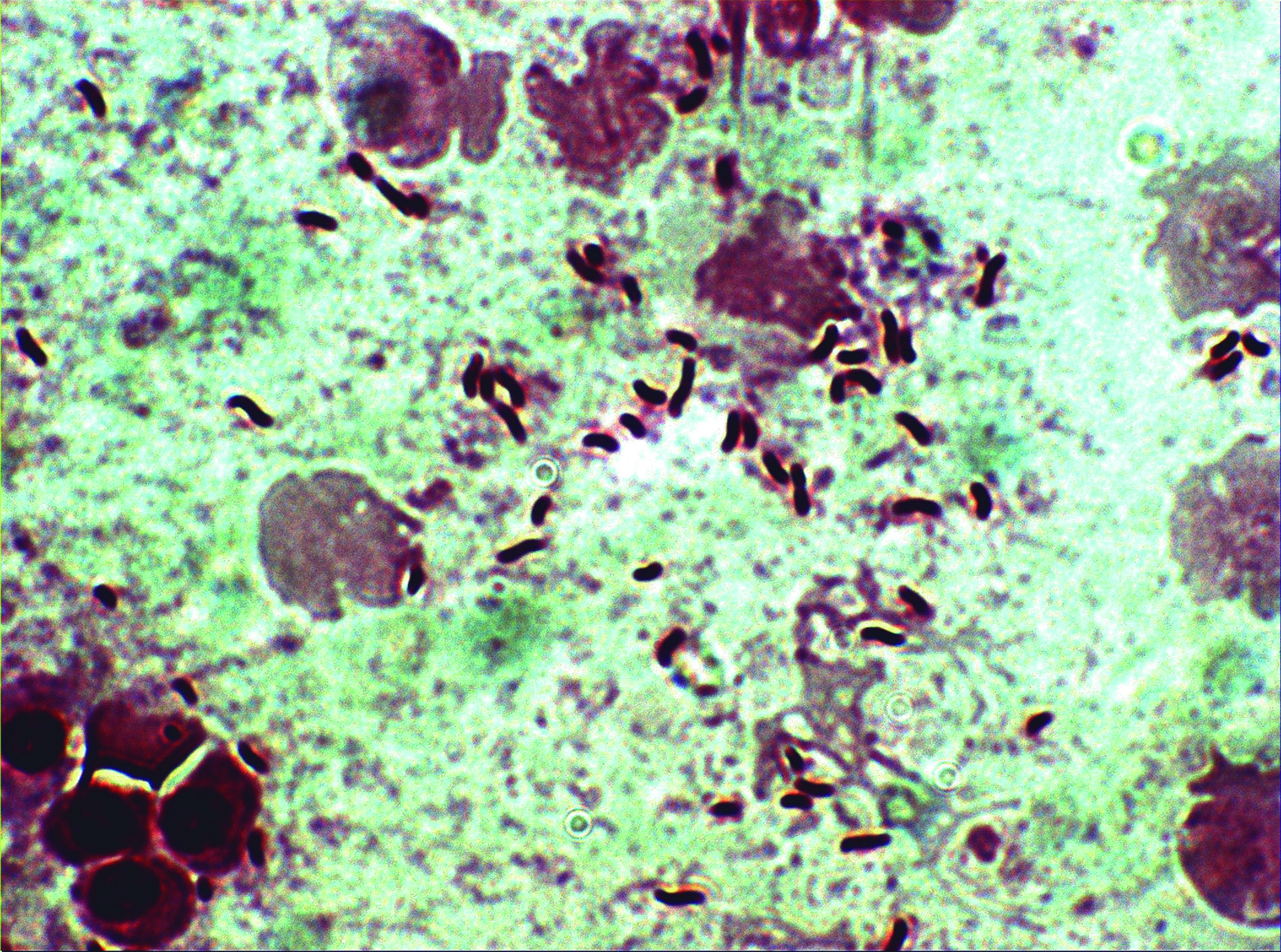 Vibriosis